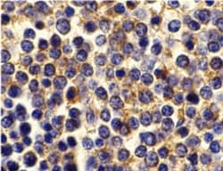 BCMA/TNFRSF17 Antibody - BSA Free, Novus Biologicals 0.1mg; Unlabeled:Antibodies,