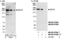 BCOR Antibody, Novus Biologicals 0.02mg; Unlabeled:Antibodies, Polyclonal