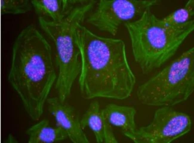 BCR Antibody, Novus Biologicals 0.1mL; Unlabeled:Antibodies, Polyclonal ...