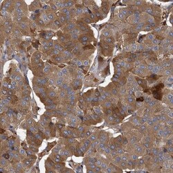 BCS1L Antibody, Novus Biologicals:Antibodies:Primary Antibodies