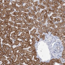 BDH1 Antibody, Novus Biologicals 0.1mL; Unlabeled:Antibodies