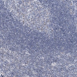 BDH1 Antibody, Novus Biologicals 0.1mL; Unlabeled:Antibodies