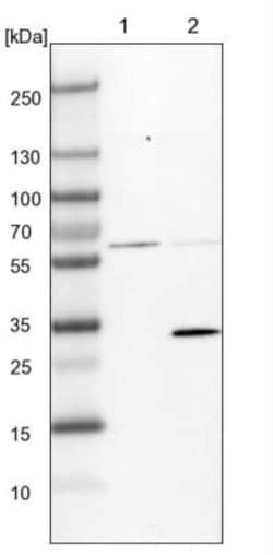 BDH1 Antibody, Novus Biologicals 0.1mL; Unlabeled:Antibodies