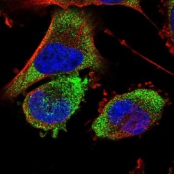 BDH2 Antibody, Novus Biologicals 0.1mL; Unlabeled:Antibodies, Polyclonal