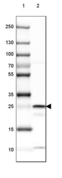 BDH2 Antibody, Novus Biologicals 0.1mL; Unlabeled:Antibodies, Polyclonal