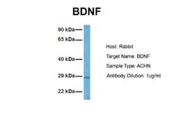 BDNF Antibody, Novus Biologicals 0.05mg; Unlabeled:Antibodies, Polyclonal
