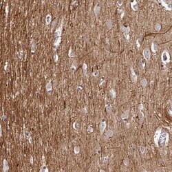 BEN Domain Containing 5 Antibody, Novus Biologicals 25 &mu;L, Unlabeled:Antibodies,