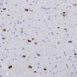 BEX5 Antibody, Novus Biologicals 25 &mu;L, Unlabeled:Antibodies, Polyclonal