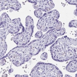 BEX5 Antibody, Novus Biologicals 25 &mu;L, Unlabeled:Antibodies, Polyclonal