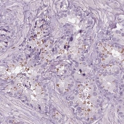 BHLHB5 Antibody, Novus Biologicals 0.1mL; Unlabeled:Antibodies, Polyclonal