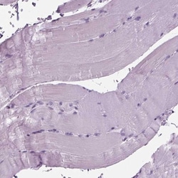 BHLHB5 Antibody, Novus Biologicals 0.1mL; Unlabeled:Antibodies, Polyclonal