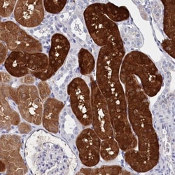 BHMT Antibody, Novus Biologicals:Antibodies:Primary Antibodies