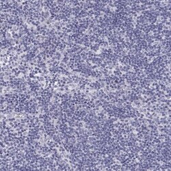 BHMT Antibody, Novus Biologicals:Antibodies:Primary Antibodies