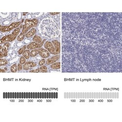 BHMT Antibody, Novus Biologicals:Antibodies:Primary Antibodies
