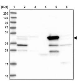 BHMT Antibody, Novus Biologicals:Antibodies:Primary Antibodies