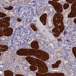 BHMT2 Antibody, Novus Biologicals:Antibodies:Primary Antibodies