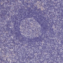 BHMT2 Antibody, Novus Biologicals:Antibodies:Primary Antibodies