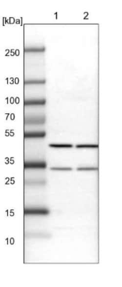 BHMT2 Antibody, Novus Biologicals:Antibodies:Primary Antibodies