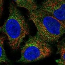 BICC1 Rabbit anti-Human, Polyclonal, Novus Biologicals:Antibodies:Primary
