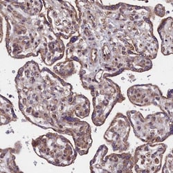 BICC1 Antibody, Novus Biologicals 0.1mL; Unlabeled:Antikörper