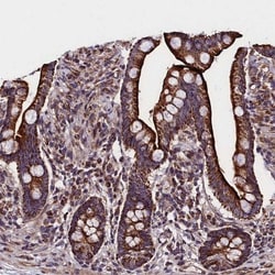 BICC1 Antibody, Novus Biologicals 0.1mL; Unlabeled:Antikörper