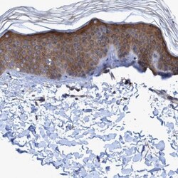 BICD2 Antibody, Novus Biologicals:Antibodies:Primary Antibodies