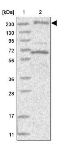 BIG3 Antibody, Novus Biologicals 25 &mu;L | Buy Online | Novus Biologicals | Fisher Scientific