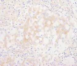BIRC6 Antibody, Novus Biologicals 0.1mL; Unlabeled:Antikörper