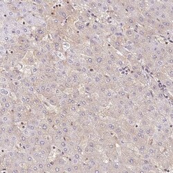 BLMH/Bleomycin Hydrolase Antibody, Novus Biologicals:Antibodies:Primary