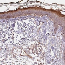 BLMH/Bleomycin Hydrolase Antibody, Novus Biologicals:Antibodies:Primary