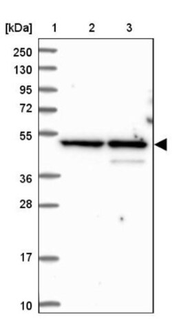 BLMH/Bleomycin Hydrolase Antibody, Novus Biologicals:Antibodies:Primary
