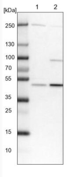 BLMH/Bleomycin Hydrolase Antibody, Novus Biologicals:Antibodies:Primary