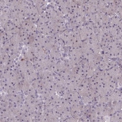 BLNK Antibody, Novus Biologicals:Antibodies:Primary Antibodies