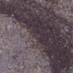 BLOS3 Rabbit anti-Human, Polyclonal, Novus Biologicals:Antibodies:Primary