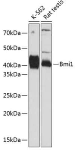 BMI-1 Rabbit anti-Human, Rat, Clone: 6H9B0, Novus Biologicals 100 &mu;g;