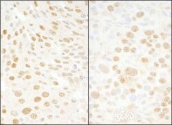 BMI-1 Antibody, Novus Biologicals 0.1mg; Unlabeled:Antibodies, Polyclonal