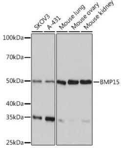 BMP-15/GDF-9B Rabbit anti-Human, Mouse, Rat, Clone: 6K5C3, Novus Biologicals