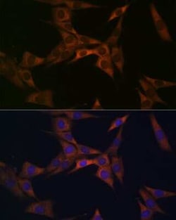 BMP-6 Rabbit anti-Human, Mouse, Rat, Clone: 6N5S9, Novus Biologicals:Antibodies:Primary