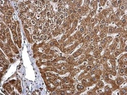 BMPR-IB/ALK-6 Antibody, Novus Biologicals 0.1mL; Unlabeled:Antibodies,