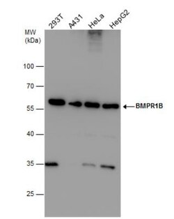BMPR-IB/ALK-6 Antibody, Novus Biologicals 0.1mL; Unlabeled:Antibodies,