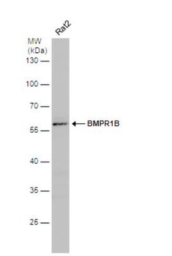 BMPR-IB/ALK-6 Antibody, Novus Biologicals 0.1mL; Unlabeled:Antibodies,