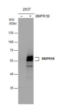 BMPR-IB/ALK-6 Antibody, Novus Biologicals 0.1mL; Unlabeled:Antibodies,