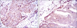BMPR-II Antibody (1F12), Novus Biologicals 0.1mL; Unlabeled:Antibodies,