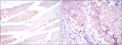 BMPR-II Antibody (3F6), Novus Biologicals:Antibodies:Primary Antibodies
