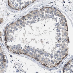 BNC2 Antibody, Novus Biologicals 0.1mL; Unlabeled:Antibodies, Polyclonal