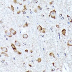 BNIP1 Rabbit anti-Human, Mouse, Rat, Clone: 10K6T9, Novus Biologicals 20