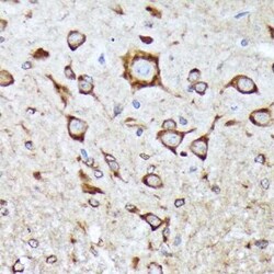 BNIP1 Rabbit anti-Human, Mouse, Rat, Clone: 10K6T9, Novus Biologicals 20