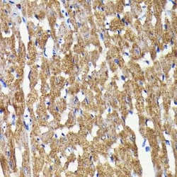 BNIP3 Rabbit anti-Human, Mouse, Rat, Clone: 7Q7V3, Novus Biologicals:Antibodies:Primary