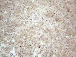 NT-proBNP Antibody (OTI11G4), Novus Biologicals 0.1mL; Unlabeled:Antibodies