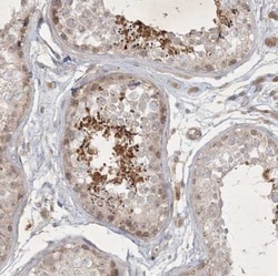 BOD1 Antibody, Novus Biologicals 25 &mu;L; Unlabeled:Antibodies, Polyclonal